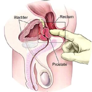 ponto-g-homem-300x300 ponto-g-homem