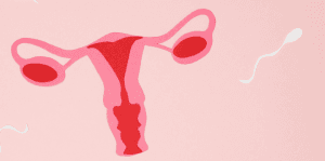 Julianna-Santos-660-×-328-px-7-1-300x149 Hidrossalpinge