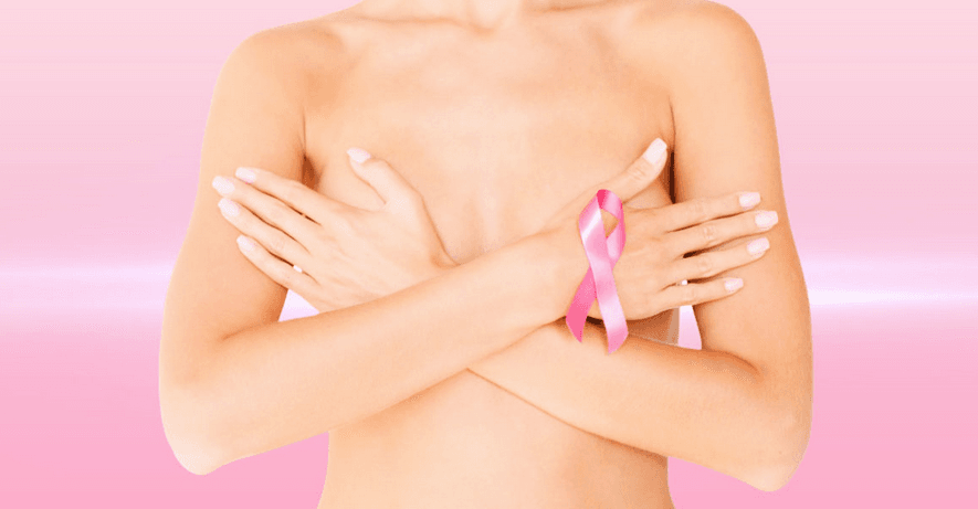 reconstrucao-mamaria