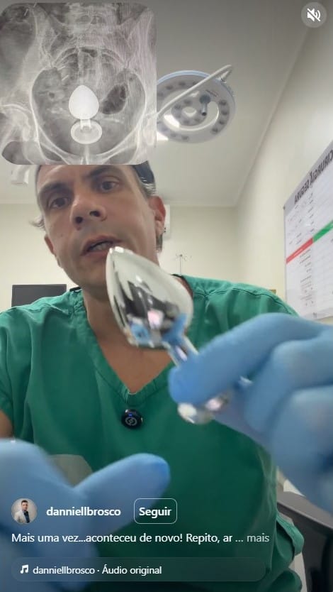 medico-plug-anal Pode parar no hospital: o risco real por trás de um plug anal